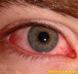 Глазные инфекции