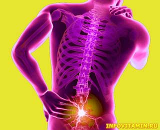 Спина, боли в ней — симптомы, причины, лечение травами, витаминами и добавками